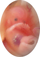 Fetus ellipse.jpg