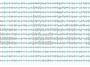 ElectroEncephalogram.png