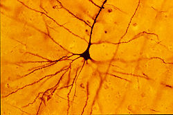 GolgiStainedPyramidalCell.jpg