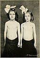 Nutrition and growth in children (1922) (14597833917).jpg